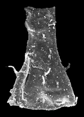 <i><i>Ramochitina ruhnuensis</i></i><br />Kolka 54 borehole, 575.00 m, Adavere Stage ( 546-39)