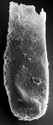 <i><i>Chitinozoa</i> | Conochitina cf. protracta (Zaslavskaya, 1980)</i><br />Ikla borehole, 422.90 m, Raikküla Stage ( 272-121)