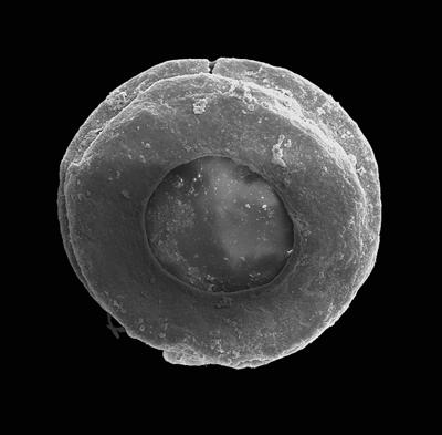 <i><i>Chitinozoa</i> | Calpichitina cf. hemsiensis (Laufeld, 1974)</i><br />Pavilosta 51 borehole, 641.20 m, Ludfordian ( 576-58)