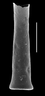 <i><i>Euconochitina electa</i></i><br />Paatsalu 527 borehole, 113.67 m, Llandovery ( 493-6)