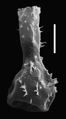 <i><i>Chitinozoa</i> | Ramochitina sp. 3</i><br />Ohesaare borehole, 13.95 m, Kaugatuma Stage ( 607-69)