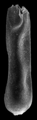 <i><i>Conochitina cucumis</i></i><br />Rapla borehole, 189.50 m, Volkhov Stage ( 190-28)
