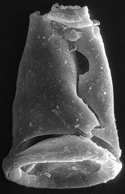 <i><i>Chitinozoa</i> | Conochitina? sp. 3 Nestor, 1994</i><br />Ruhnu 500 borehole, 463.20 m, Adavere Stage ( 272-139)