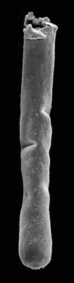 <i><i>Conochitina</i> | Conochitina cf. leptosoma Laufeld, 1974</i><br />Kaugatuma 509 borehole, 241.00 m, Adavere Stage ( 427-15)