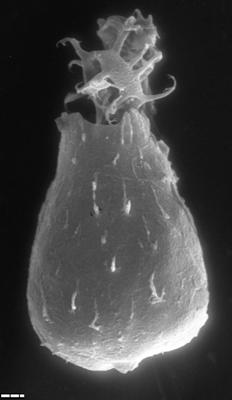 <i><i>Chitinozoa</i></i><br />Tähkvere 726 puurauk,  m, Vormsi Stage ( 1543-1)