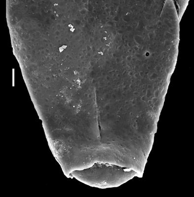 <i><i>Chitinozoa</i> | Velachitina cf. veligera Poumot, 1968</i><br />Museum of Art excavation section, Kadriorg, 0.30 m, Hunneberg Stage ( 424-79)