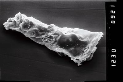 <i><i>Spinachitina fragilis</i></i><br />Ruhnu 500 borehole, 600.80 m, Juuru Stage ( 754-1017)