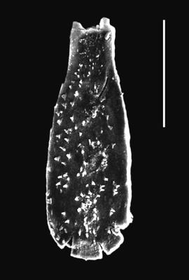 <i><i>Angochitina multiplex</i></i><br />Piilsi 729 borehole, 103.14 m, Keila Stage ( 664-2)