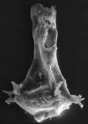 <i><i>Chitinozoa</i> | Ancyrochitina aff. convexa Nestor, 1980</i><br />Viki borehole, 189.45 m, Adavere Stage ( 272-43)