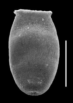 <i><i>Chitinozoa</i> | Desmochitina sp. group minor Eisenack, 1931</i><br />Museum of Art excavation section, Kadriorg, 0.30 m, Hunneberg Stage ( 424-63)