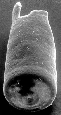<i><i>Chitinozoa</i> | Conochitina sp. 2 Nestor, 1994</i><br />Varbla 502 borehole, 156.90 m, Adavere Stage ( 272-137)
