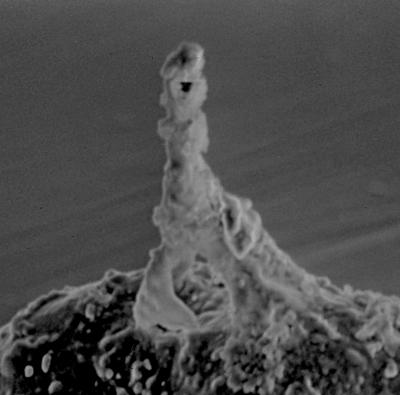<i><i>Plectochitina nodifera</i> | Ancyrochitina nodifera Nestor, 1980</i><br />Laeva 10 borehole, 124.60 m, Juuru Stage ( 212-5)