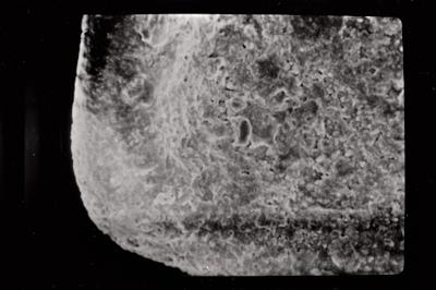 <i><i>Conochitina cribrosa</i></i><br />Ohesaare borehole, 181.45 m, Jaagarahu Stage ( 754-783)