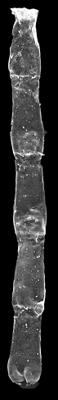 <i><i>Linochitina erratica</i></i><br />Pavilosta 51 borehole, 900.50 m, Wenlock ( 527-19)