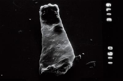 <i><i>Linochitina</i> | Linochitina sp.1</i><br />Viki borehole, 171.60 m, Adavere Stage ( 754-953)