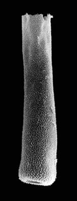 <i><i>Chitinozoa</i> | Belonechitina sp. A  Nõlvak et Bauert, 2006</i><br />Kerguta 565 borehole, 178.90 m, Aseri Formation ( 544-11)