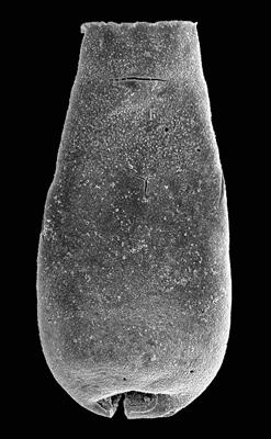<i><i>Eisenackitina elongata</i></i><br />Pavilosta 51 borehole, 711.00 m, Ludfordian ( 576-42)