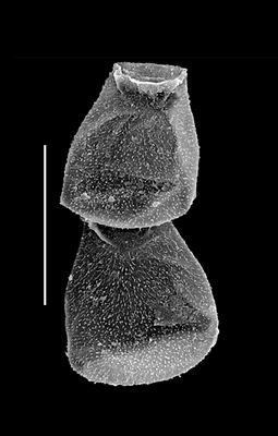 <i><i>Eisenackitina</i> | Eisenackitina sp. A</i><br />Black Knob Ridge Section,  m, Katian ( 862-1)