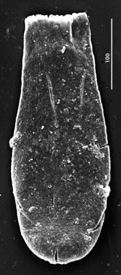 <i><i>Chitinozoa</i> | Conochitina cf. malleus nomen nudum van Grootel 1990</i><br />Aizpute 41 borehole, 972.40 m, lower Silurian ( 345-12)