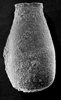 <i><i>Eisenackitina spongiosa</i></i><br />Ruhnu 500 borehole, 361.90 m, Jaagarahu Stage ( 272-101)