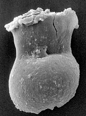 <i><i>Chitinozoa</i> | Chitinozoa gen. et sp. indet.</i><br />Kirikuküla borehole, 47.90 m, Adavere Stage ( 197-13)