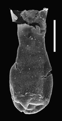 <i><i>Chitinozoa</i> | Angochitina sp. 3</i><br />Ventspils D-3 borehole, 300.00 m, Přidoli ( 607-71)