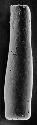 <i><i>Chitinozoa</i> | Conochitina cf. iklaensis Nestor, 1980</i><br />Sõru 400 borehole, 34.56 m, Adavere Stage ( 223-1)