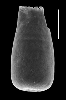 <i><i>Chitinozoa</i> | Conochitina cf. emmastensis Nestor, 1982</i><br />Paatsalu 527 borehole, 78.20 m, Llandovery ( 493-12)