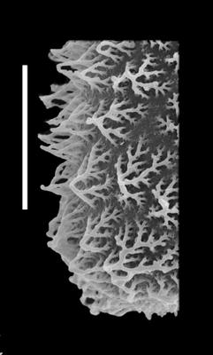 <i><i>Belonechitina robusta</i> | Belonechitina robusta (Eisenack) s.l.</i><br />Black Knob Ridge Section,  m, Katian ( 862-38)