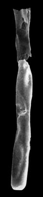 <i><i>Rhabdochitina gracilis</i></i><br />Pyhämaa, Finland,  m,  ( 307-8)