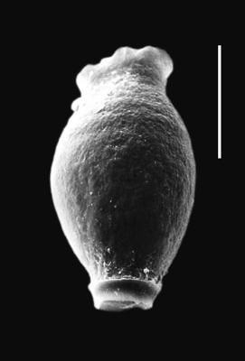 <i><i>Desmochitina juglandiformis</i></i><br />Piilsi 729 borehole, 107.13 m, Haljala Stage ( 664-8)