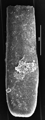 <i><i>Conochitina iklaensis</i></i><br />Aizpute 41 borehole, 972.40 m, lower Silurian ( 345-16)