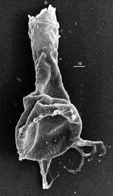 <i><i>Chitinozoa</i> | Ancyrochitina aff. ancyrea (Eisenack, 1931)</i><br />Aizpute 41 borehole, 946.55 m, lower Silurian ( 345-26)