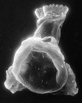 <i><i>Chitinozoa</i> | Clathrochitina cf. clathrata Eisenack, 1959</i><br />Jaagarahu borehole, 59.60 m, Adavere Stage ( 273-11)