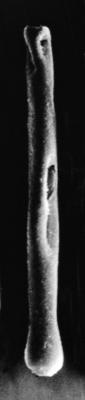 <i><i>Conochitina</i> | Conochitina cf. leptosoma Laufeld, 1974</i><br />Ruhnu 500 borehole, 392.80 m, Jaagarahu Stage ( 272-105)