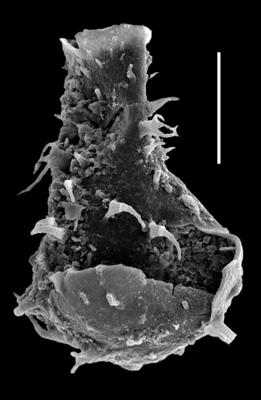 <i><i>Chitinozoa</i> | Ramochitina sp. (nov.) Hints et al., 2006</i><br />Paatsalu 527 borehole, 95.76 m, Llandovery ( 493-19)