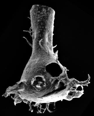 <i><i>Chitinozoa</i> | Plectochitina sp. 1 Nestor, 1994</i><br />Ohesaare borehole, 174.40 m, Jaagarahu Stage ( 220-61)