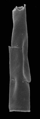 <i><i>Rhabdochitina? tallinnensis</i> | Tanuchitina tallinnensis Grahn, 1984</i><br />Kerguta 565 borehole, 179.52 m, Aseri Formation ( 544-42)