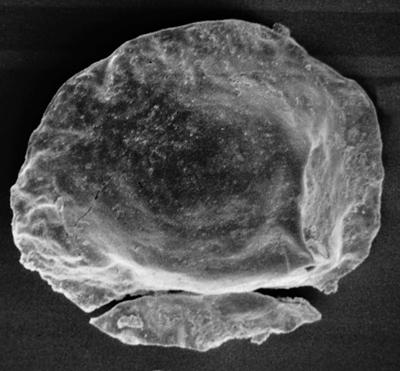 <i><i>Pterochitina macroptera</i> | Pterochitina macroptera ( Eisenack, 1959)</i><br />Pulli 1 borehole, 17.70 m, Jaani Stage ( 220-10)