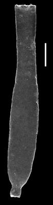 <i><i>Eremochitina</i> | Eremochitina sp. A, aff. baculata Taugourdeau et de Jekhowsky 1960</i><br />Museum of Art excavation section, Kadriorg, 0.30 m, Hunneberg Stage ( 424-70)