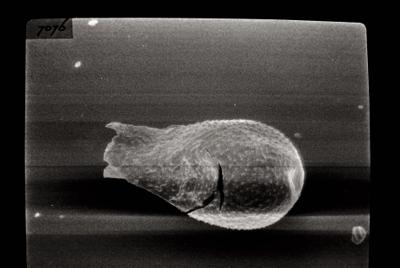 <i><i>Angochitina longicollis</i></i><br />Varbla 502 borehole, 132.10 m, Adavere Stage ( 754-98)