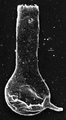 <i><i>Chitinozoa</i> | Plectochitina cf. spongiosa (Achab, 1977)</i><br />Aizpute 41 borehole, 982.60 m, lower Silurian ( 345-8)
