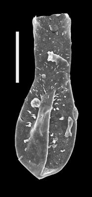 <i><i>Angochitina</i> | Angochitina cf. paucispinosa Miller, Sutherland et Dorning, 1997</i><br />Dubovskoye borehole, 1202.00 m, Ludlow ( 607-8)