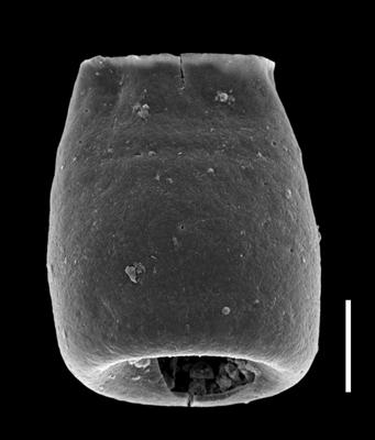 <i><i>Eisenackitina inanulifera</i></i><br />Paatsalu 527 borehole, 80.10 m, Llandovery ( 493-4)