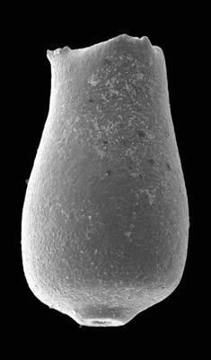 <i><i>Chitinozoa</i> | Eisenackitina sp. 4 Nestor, 2009</i><br />Pavilosta 51 borehole, 623.20 m, Ludfordian ( 576-62)