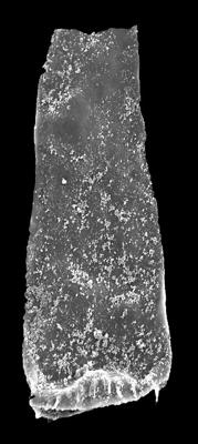 <i><i>Spinachitina fragilis</i></i><br />Kolka 54 borehole, 660.50 m, Juuru Stage ( 546-3)