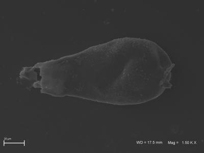 <i><i>Ancyrochitina</i> | Ancyrochitina sp. 3</i><br />Ventspils D-3 borehole, 300.00 m, Kaugatuma Stage ( 754-1813)