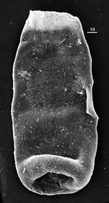 <i><i>Chitinozoa</i> | Conochitina sp. 6  Nestor, 1994</i><br />Aizpute 41 borehole, 960.95 m, lower Silurian ( 345-21)
