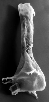 <i><i>Chitinozoa</i> | Ancyrochitina cf. clathrospinosa Eisenack, 1968</i><br />Vängla trench,  m, Adavere Stage ( 272-41)