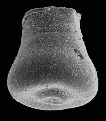 <i><i>Chitinozoa</i> | Eisenackitina sp. 3 Nestor, 2009</i><br />Pavilosta 51 borehole, 626.20 m, Ludfordian ( 576-64)